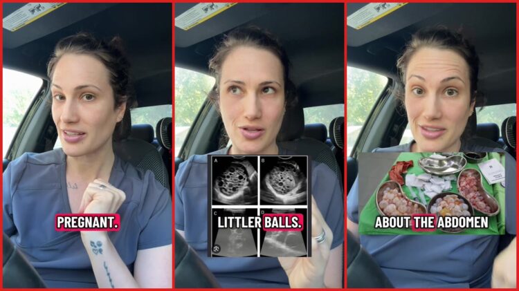 32-year-old woman’s abdomen was so distended staff asked how far along she was. Then tests revealed she wasn’t pregnant at all 1 32-year-old woman’s abdomen was so distended staff asked how far along she was. Then tests revealed she wasn’t pregnant at all — stills from the TikTok posted by Miranda Shea ❤️ FNP